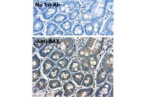 Immunohistochemistry (IHC) image for anti-BCL2-Associated X Protein (BAX) (N-Term) antibody (ABIN6254209) (BAX anticorps  (N-Term))