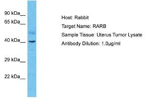 Host: Rabbit Target Name: RARB Sample Type: Uterus Tumor lysates Antibody Dilution: 1. (Retinoic Acid Receptor beta anticorps  (N-Term))