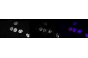 Image no. 1 for anti-RNA Polymerase II CTD (pSer5) antibody (ABIN1742594) (Rpb1 CTD anticorps  (pSer5))