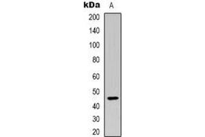 Western blot analysis of Plasma Kallikrein HC expression in Hela (A) whole cell lysates. (KLKB1 anticorps  (Heavy Chain))