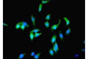 Immunofluorescent analysis of Hela cells using ABIN7163258 at dilution of 1:100 and Alexa Fluor 488-congugated AffiniPure Goat Anti-Rabbit IgG(H+L) (PCK1 anticorps  (AA 1-622))