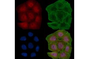 ABIN6264679 and ABIN6278276 staining Hela cells(30 min of UV treatment) by IF/ICC. (RCC1 anticorps  (N-Term))