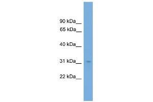 WB Suggested Anti-NRBF2 Antibody Titration:  0. (NRBF2 anticorps  (N-Term))