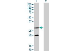 Western Blot analysis of DIABLO expression in transfected 293T cell line by DIABLO monoclonal antibody (M02A), clone 4F9. (DIABLO anticorps  (AA 119-218))