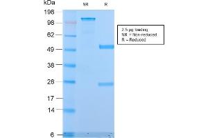 SDS-PAGE Analysis Purified MUC1 Rabbit Recombinant Monoclonal Antibody (MUC1/2818R).