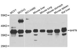 Western blot analysis of extracts of various cell lines, using rprd1b antibody (ABIN4905047) at 1:1000 dilution.