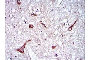 Immunohistochemical analysis of paraffin-embedded brain tissues using NEFL mouse mAb with DAB staining. (NEFL anticorps)