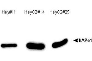 Image no. 1 for anti-DNA Repair Protein Apurinic Endonuclease antibody (ABIN5693483) (DNA Repair Protein Apurinic Endonuclease anticorps)