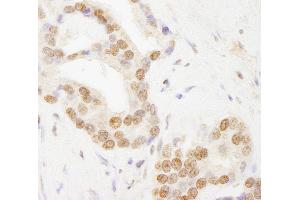 anti-TAF6 RNA Polymerase II, TATA Box Binding Protein (TBP)-Associated Factor, 80kDa (TAF6) (AA 627-677) antibody