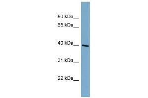 ST8SIA6 antibody used at 1 ug/ml to detect target protein. (ST8SIA6 anticorps  (Middle Region))