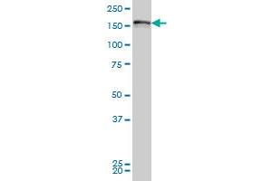 LRRFIP1 monoclonal antibody (M02), clone 2D3 Western Blot analysis of LRRFIP1 expression in Hela S3 NE . (LRRFIP1 anticorps  (AA 675-784))