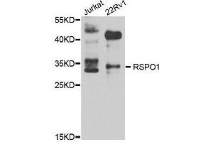 Western blot analysis of extract of various cells, using RSPO1 antibody. (RSPO1 anticorps)