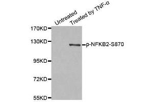 Western blot analysis of extract from MDA-MB-435 cells, using Phospho-NFKB2-S870 antibody (ABIN2988217). (NFKB2 anticorps  (pSer870))