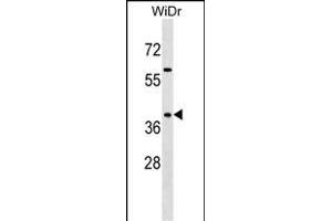SY Antibody (C-term) 7291b western blot analysis in WiDr cell line lysates (35 μg/lane). (SYAP1 anticorps  (C-Term))