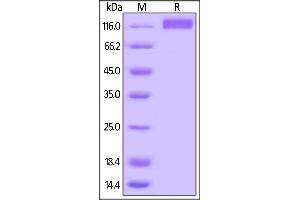 Biotinylated Human VEGF R3, His,Avitag on  under reducing (R) condition.