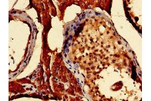 Immunohistochemistry of paraffin-embedded human testis tissue using ABIN7166049 at dilution of 1:100 (S100A16 anticorps  (AA 1-103))