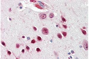 Human Brain, Cortex (formalin-fixed, paraffin-embedded) stained with NOVA1 antibody ABIN461953 at 2. (NOVA1 anticorps  (AA 121-134))
