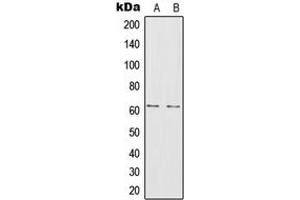 Western blot analysis of IL-20RA expression in A375 (A), MCF7 (B) whole cell lysates. (IL20RA anticorps  (Center))
