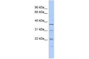 WB Suggested Anti-MCTS1 Antibody Titration:  0. (MCTS1 anticorps  (N-Term))