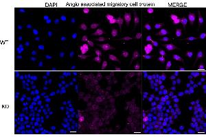 anti-Angio-Associated, Migratory Cell Protein (AAMP) antibody