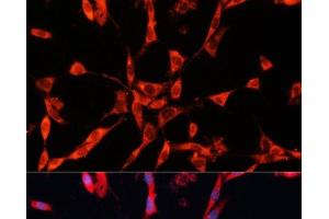 Immunofluorescence analysis of NIH/3T3 cells using GARS Polyclonal Antibody at dilution of 1:100.