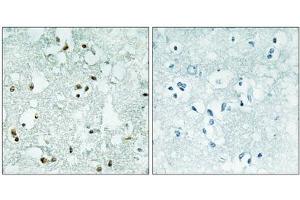 Immunohistochemistry analysis of paraffin-embedded human brain tissue, using ELAC2 antibody. (ELAC2 anticorps  (Internal Region))