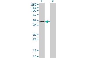 Western Blot analysis of TRIB3 expression in transfected 293T cell line by TRIB3 monoclonal antibody (M03), clone 1H2.