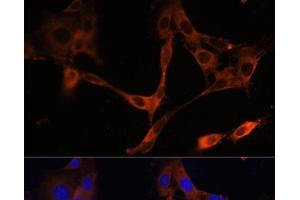 Immunofluorescence analysis of NIH/3T3 cells using HMGCR Polyclonal Antibody at dilution of 1:100. (HMGCR anticorps)