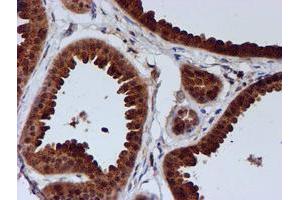 Immunohistochemistry (IHC) image for anti-Chromosome 1 Open Reading Frame 50 (C1ORF50) antibody (ABIN1497033)