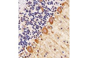 Immunohistochemical analysis of paraffin-embedded M.