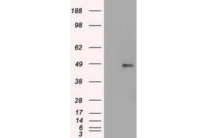 HEK293T cells were transfected with the pCMV6-ENTRY control (Left lane) or pCMV6-ENTRY FOXA1 (Right lane) cDNA for 48 hrs and lysed. (FOXA1 anticorps  (AA 1-473))