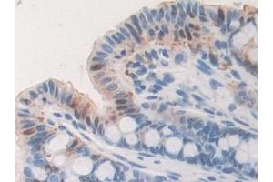 Detection of FGB in Mouse Small intestine Tissue using Polyclonal Antibody to Fibrinogen Beta Chain (FGB)