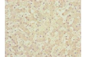 Immunohistochemistry of paraffin-embedded human liver tissue using ABIN7147366 at dilution of 1:100
