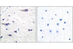 Immunohistochemistry analysis of paraffin-embedded human brain tissue, using PDGF Receptor beta (Ab-751) Antibody. (PDGFRB anticorps  (AA 718-767))