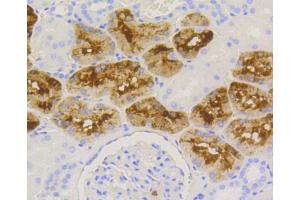 Immunohistochemistry of paraffin-embedded human kidney using LYZ antibody (ABIN5997039) at dilution of 1/100 (40x lens).