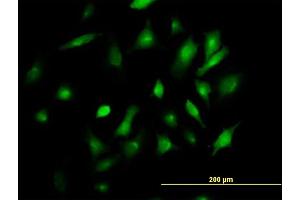 Immunofluorescence of purified MaxPab antibody to BST2 on HeLa cell. (BST2 anticorps  (AA 1-180))