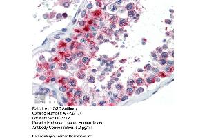 Immunohistochemistry with Human Testis lysate tissue at an antibody concentration of 5.