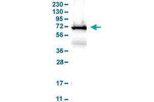 Western Blot analysis of human cell line RT-4. (LCP1 anticorps  (AA 18-77))
