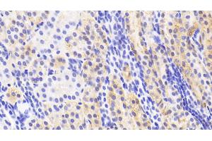 Detection of NAGa in Human Kidney Tissue using Polyclonal Antibody to N-Acetylgalactosaminidase Alpha (NAGa)
