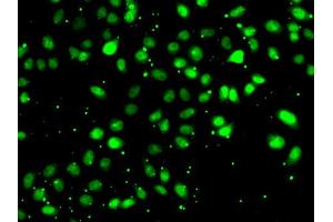Immunofluorescence analysis of HeLa cell using NUDT2 antibody. (NUDT2 anticorps)