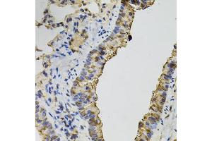 Immunohistochemistry of paraffin-embedded mouse lung using DNM2 antibody (ABIN5970189) (40x lens). (DNM2 anticorps)