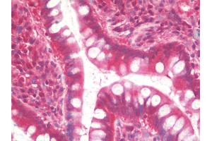 Anti-TCL / RHOJ antibody IHC staining of human small intestine. (RHOJ anticorps)