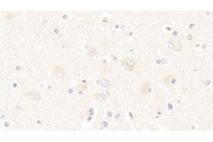 Detection of TWSG1 in Human Cerebrum Tissue using Polyclonal Antibody to Twisted Gastrulation Protein Homolog 1 (TWSG1) (TWSG1 anticorps  (AA 26-223))