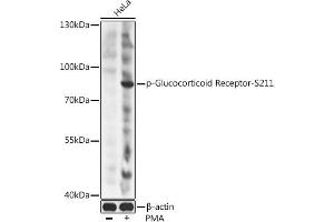 Western blot analysis of extracts of HeLa cells, using Phospho-Glucocorticoid Receptor-S211 antibody (ABIN6135269, ABIN6136160, ABIN6136161 and ABIN6225653) at 1:2000 dilution. (Glucocorticoid Receptor anticorps  (pSer211))