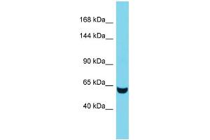 Western Blotting (WB) image for anti-Tensin 3 (TNS3) (C-Term) antibody (ABIN2790595) (TNS3 anticorps  (C-Term))