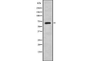 Western blot analysis of TBX15/18 using HepG2 whole cell lysates (T-Box 15/18 anticorps)