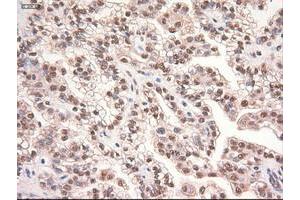 Image no. 9 for anti-Myc Proto-Oncogene protein (MYC) antibody (ABIN1497013) (c-MYC anticorps)
