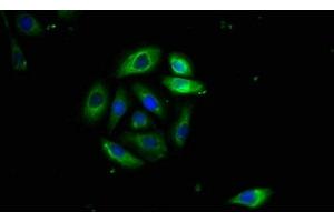 Immunofluorescence staining of A549 cells with ABIN7173891 at 1:400, counter-stained with DAPI.