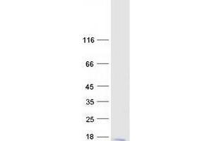 Validation with Western Blot