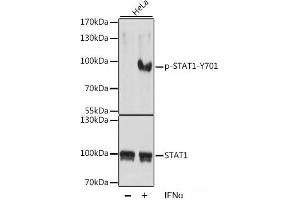 Western blot analysis of extracts of HeLa cells using Phospho-STAT1(Y701) Polyclonal Antibody at dilution of 1:1000. (STAT1 anticorps  (pTyr701))